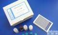 E-<em>Selectin</em>/CD62E<em>试剂盒</em>,人E<em>选择</em>素Elisa<em>试剂盒</em>
