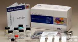 <em>人抗脱氧核糖核蛋白抗体试剂盒</em>价格