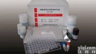 人<em>胶原酶</em>I(<em>Collagenase</em> I)ELISA试剂盒 ，<em>原装进口</em>96T 酶联检测