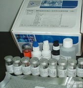 人血小板相关<em>补体</em>3<em>试剂盒</em>,血小板相关<em>补体</em>3<em>试剂盒</em>,血小板相关<em>补体</em>3<em>试剂盒</em>供应商