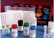 <em>激活</em>素<em>受体</em>2B/<em>激活</em>素<em>受体</em>相互作用蛋白2b抗体,ARIP2B抗体