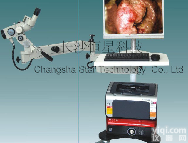 尼康<em>光电</em><em>一体</em><em>阴道</em>镜，<em>阴道</em>镜厂家直销