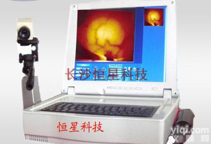 手提式精<em>品红</em>外乳腺诊断仪<em>生产厂家</em>直销，红外乳透价格多少