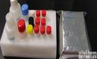 人生长<em>激素</em>释放肽ghrelinelisa<em>试剂盒</em>/GHRP-Ghrelin<em>测试盒</em>/GHRP-Ghrelinelisa<em>试剂盒</em>