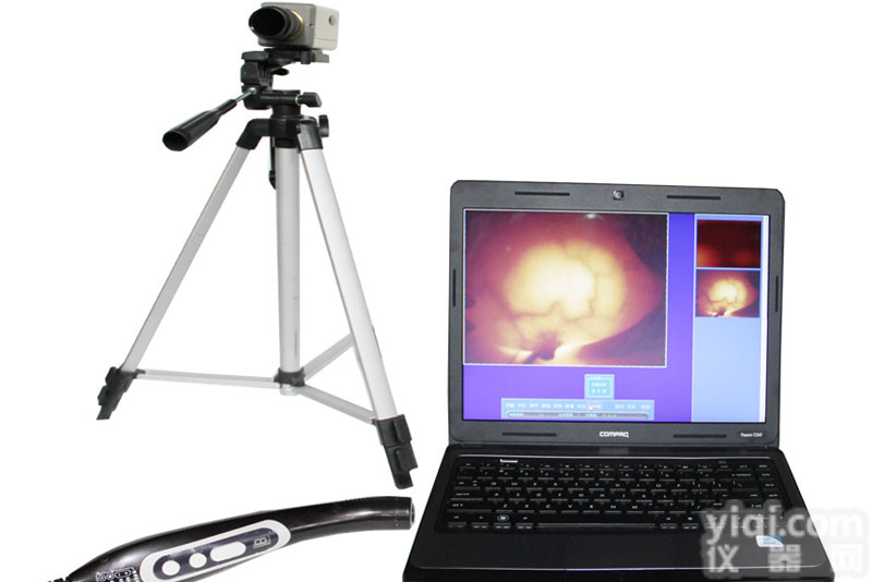 笔记本乳房<em>诊断仪</em>，笔记本<em>乳腺</em>检查仪，笔记本红外照透仪