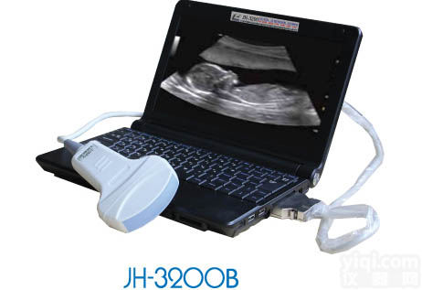 笔记本b超<em>诊断仪</em>，Z轻便超薄笔记本b超机，笔记本数字<em>超声</em>机<em>生产厂家</em>