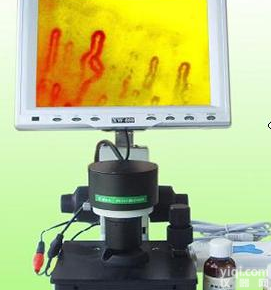 供应微循环<em>末梢</em>血管<em>检测仪</em>