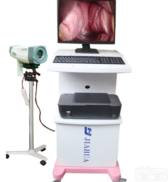 <em>普通型</em>数码电子<em>阴道</em>镜