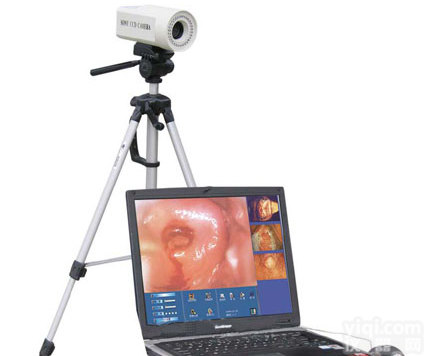 便携式数码电子<em>阴道</em>镜生产<em>厂家</em>