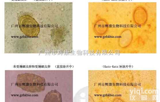 四川<em>寄生虫卵检测试剂盒</em>（改良加藤氏法）