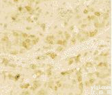 <em>前列腺癌</em><em>组织</em>源性原代细胞