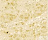 <em>Agarose</em> <em>琼脂</em>糖(<em>西班牙</em>分装）