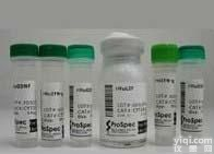 Anti-Apo J/<em>Clusterin</em>-α/β<em>抗体</em>，凝聚素α/β<em>抗体</em> IHC WB