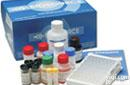 人<em>视黄醇</em>结合蛋白4(RBP-4)ELISA<em>试剂盒</em>，产品<em>价格</em>