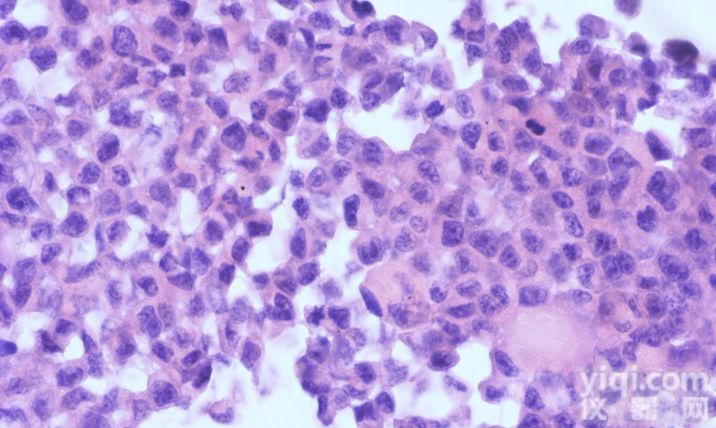 <em>虹膜</em><em>色素</em><em>上皮</em>细胞 ,细胞供应