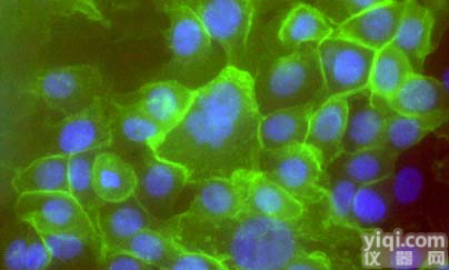 <em>前列腺癌</em><em>组织</em>源性原代细胞,细胞供应