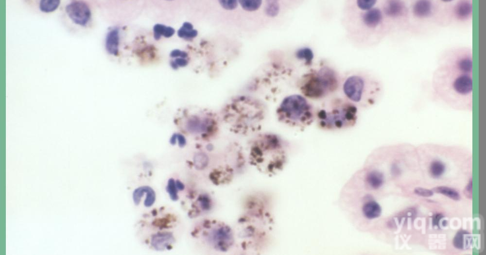 脐<em>静脉</em><em>平滑肌</em><em>细胞</em>,<em>细胞</em>供应