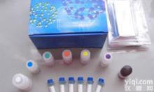 人抗小核糖<em>核蛋白</em>/Sm抗体Elisa<em>试剂盒</em>，snRNP/Sm<em>试剂盒</em>