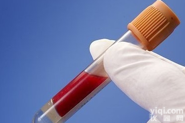 紧密连接蛋白<em>抗体</em>,Anti-OCLN/<em>Occludin</em><em>抗体</em>报价