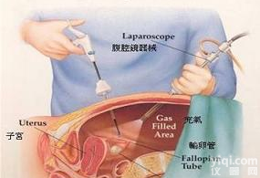 <em>腹腔镜</em>模拟<em>训练器</em>