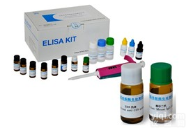 人抗肌内膜抗体<em>IgA</em><em>试剂盒</em>人(EMA <em>IgA</em>)<em>ELISA</em><em>试剂盒</em>