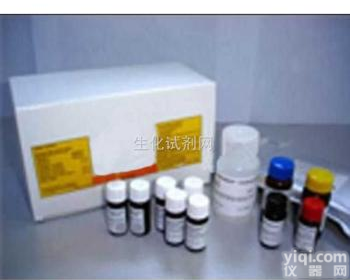 <em>弓形</em>虫IgG抗体测定<em>试剂盒</em>价格,<em>弓形</em>虫IgG抗体测定<em>试剂盒</em>用途