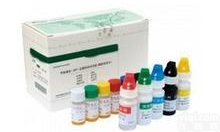 大鼠磷脂酶C(PLC)elisa<em>试剂盒</em>价格,<em>南京</em>大鼠磷脂酶C(PLC)elisa<em>试剂盒</em>