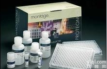 人免疫球蛋白G3(IgG3)elisa<em>试剂</em>盒直销,<em>安徽</em>elisa<em>试剂</em>盒