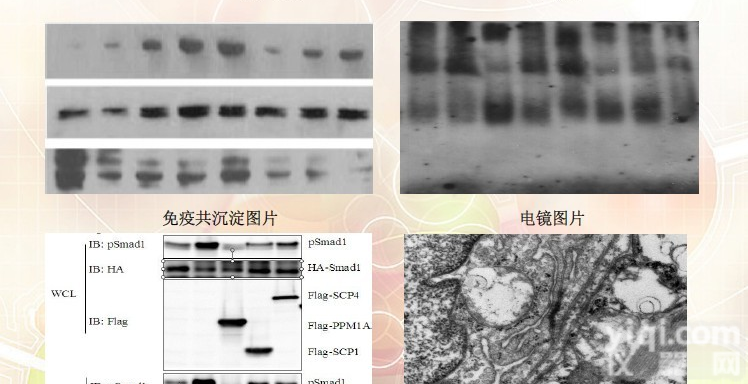 <em>Western Blot技术服务</em>，WB免疫印迹，WB实验代测