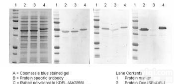 <em>蛋白质</em>印迹western blot检测
