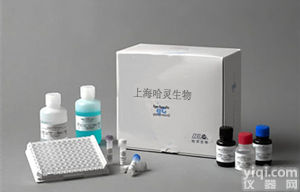 人N-乙酰-β-D-氨基葡萄<em>糖苷酶</em>(NAG)ELISA<em>试剂</em>盒  <em>上海</em>价格