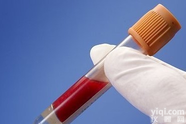 Anti-TRA16,睾丸激素孤儿<em>受体</em>相关蛋白<em>抗体</em>来电<em>咨询</em>