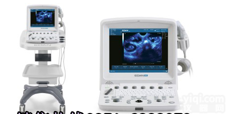 全数字<em>彩超</em>-便携<em>彩超</em>-<em>彩超</em>使用说明-<em>彩超</em>价格-<em>彩超</em><em>生产厂家</em>