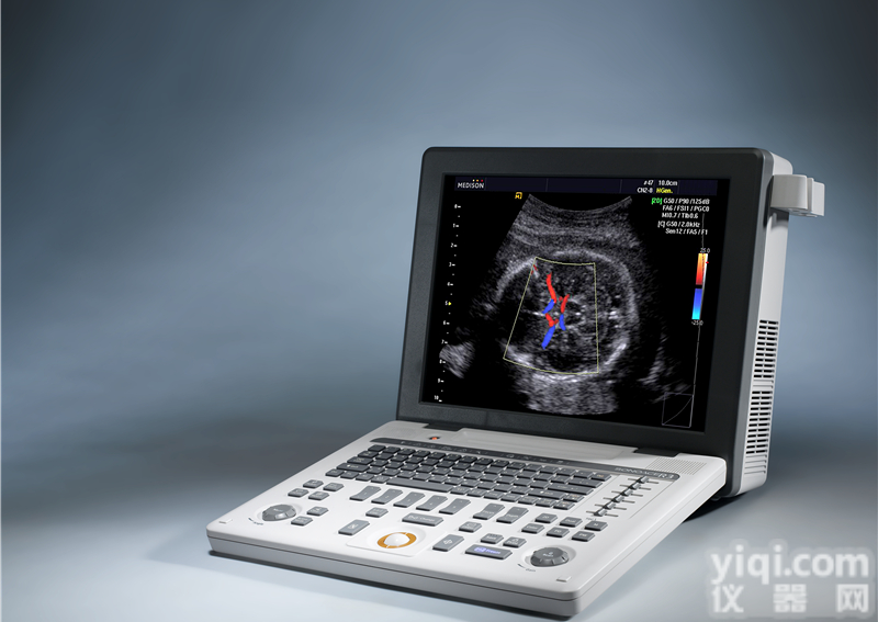 <em>便携式</em>彩色超声<em>诊断仪</em>麦迪逊<em>彩超</em>sonoace r3