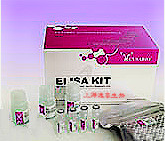 进口ELISA检测<em>试剂盒</em>,小鼠α<em>甘露</em><em>糖苷酶</em>(α Manase)ELISA<em>试剂盒</em>