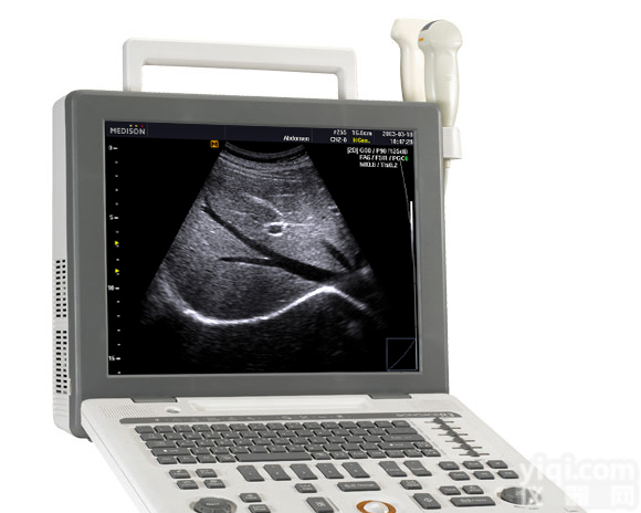 三星麦迪逊便携<em>彩超</em>SONOACE R3彩色<em>多普勒</em>超声<em>诊断仪</em>