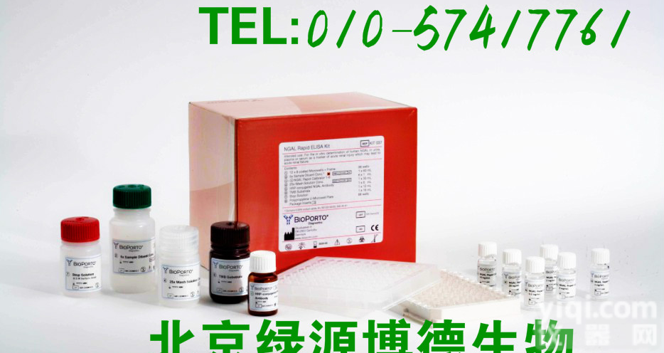 大鼠<em>肉毒碱</em>脂酰转移酶(CACT)elisa<em>试剂盒</em>SY<em>说明书</em>