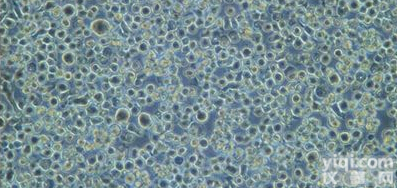 「<em>Daudi</em><em>细胞</em>」人<em>淋巴瘤</em><em>细胞</em>