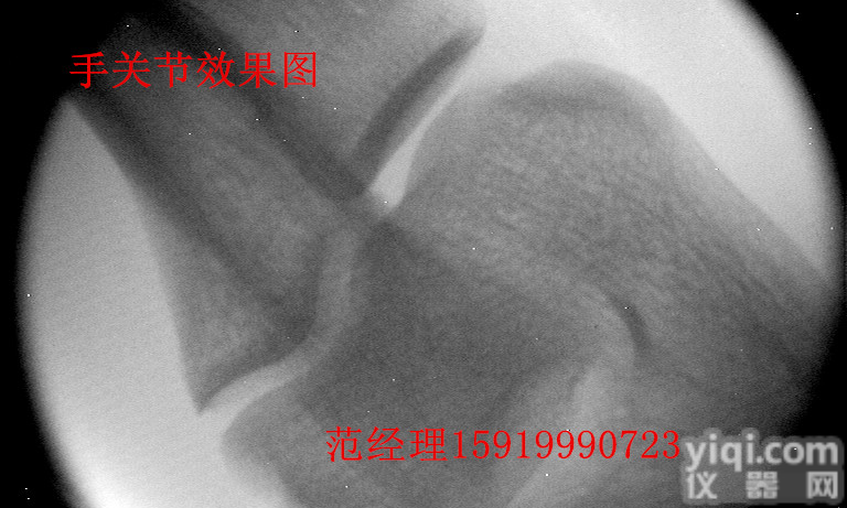 四肢X<em>光机</em>医用X<em>光机</em>便携式<em>手提式</em>X<em>光机</em>