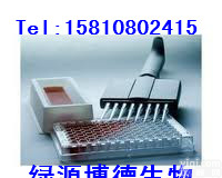 人基质金属蛋白酶2/<em>明胶</em>酶A Elisa<em>北京</em>代测,人MMP-2/Gelatinase A  ELISA检测试剂盒