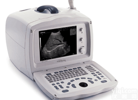 北信Pai 全数字<em>便携式</em>超声诊断系统 经济型全数字<em>便携式</em>超生诊断分析仪 <em>便携式</em>超生<em>诊断仪</em>