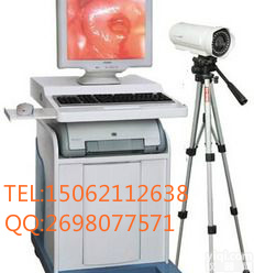 数码<em>电子</em><em>阴道</em>镜生产厂家，<em>阴道</em>镜价格，<em>阴道</em>镜特价销售，<em>阴道</em>镜代理