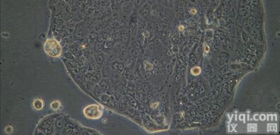 NIT-1<em>小鼠</em>胰岛素瘤β细胞(NOD/Lt<em>转基因</em><em>小鼠</em>，SV40巨T<em>抗原</em>)