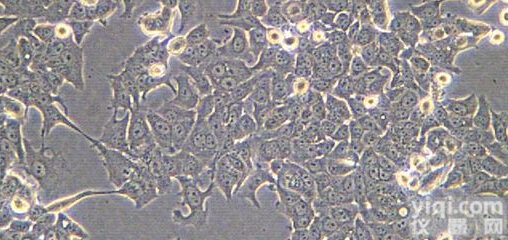 Walker-256大鼠肝<em>癌细胞</em>(乳腺<em>癌细胞</em><em>接种</em>到肝脏成瘤)