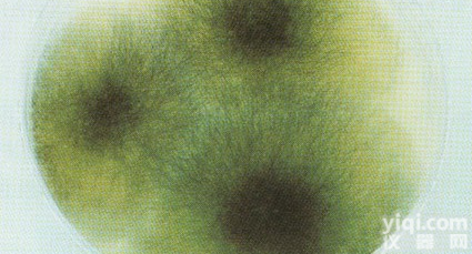 <em>黑化</em>链<em>霉菌</em>