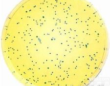 <em>明胶</em><em>培养基</em>（<em>营养</em><em>明胶</em><em>培养基</em>）