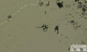 <em>黑化</em>链<em>霉菌</em>