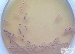 <em>绿色</em>木霉=木<em>素木</em>霉