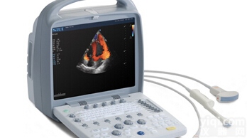 <em>汕头</em>超声Apogee1200全方位数字化手提便携式<em>彩超</em>