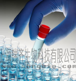 ABCB6<em>蛋白</em><em>抗原</em>，ATP结合<em>蛋白</em>家族6<em>蛋白</em><em>抗原</em>